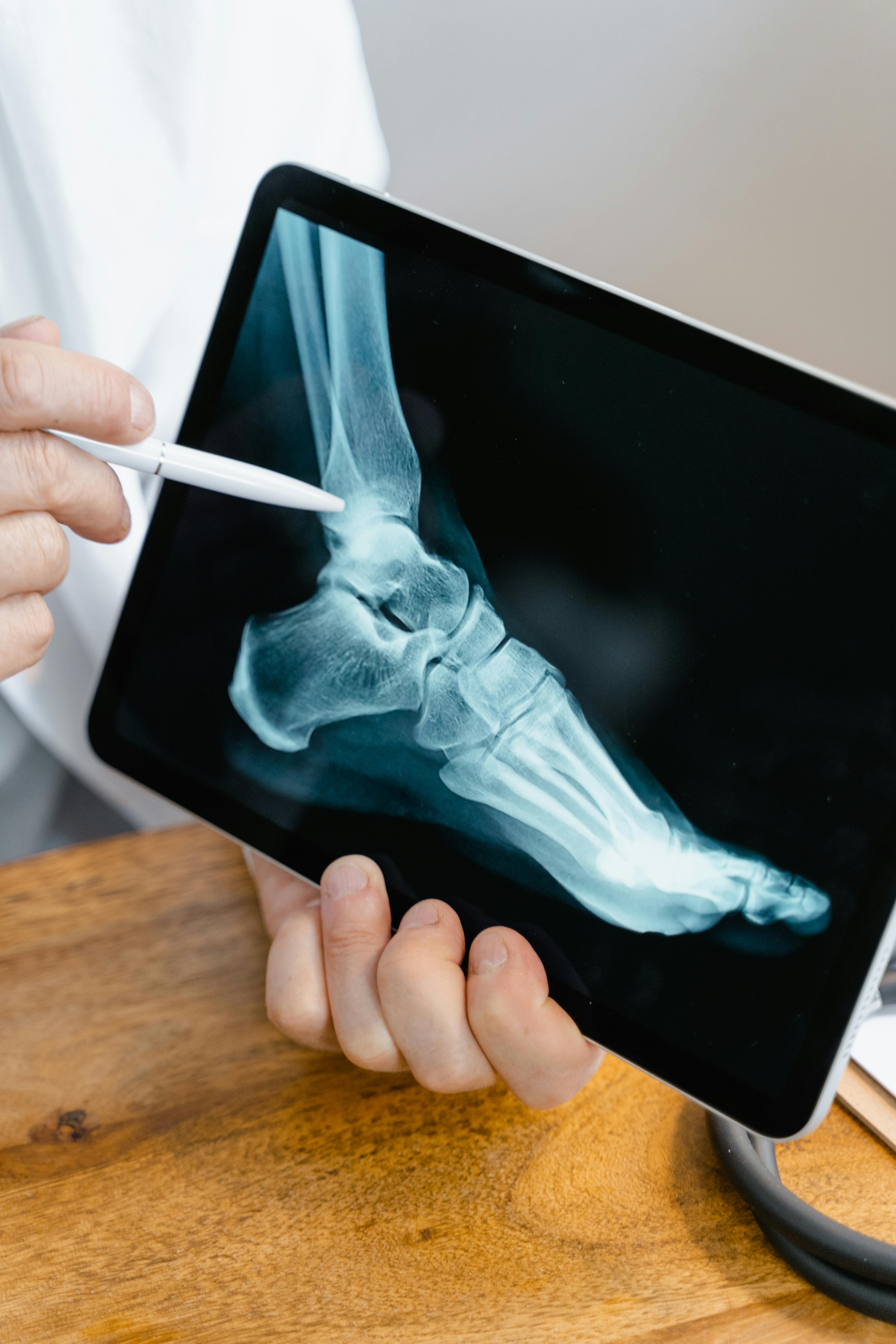 Radiografía de pie analizada en consulta médica