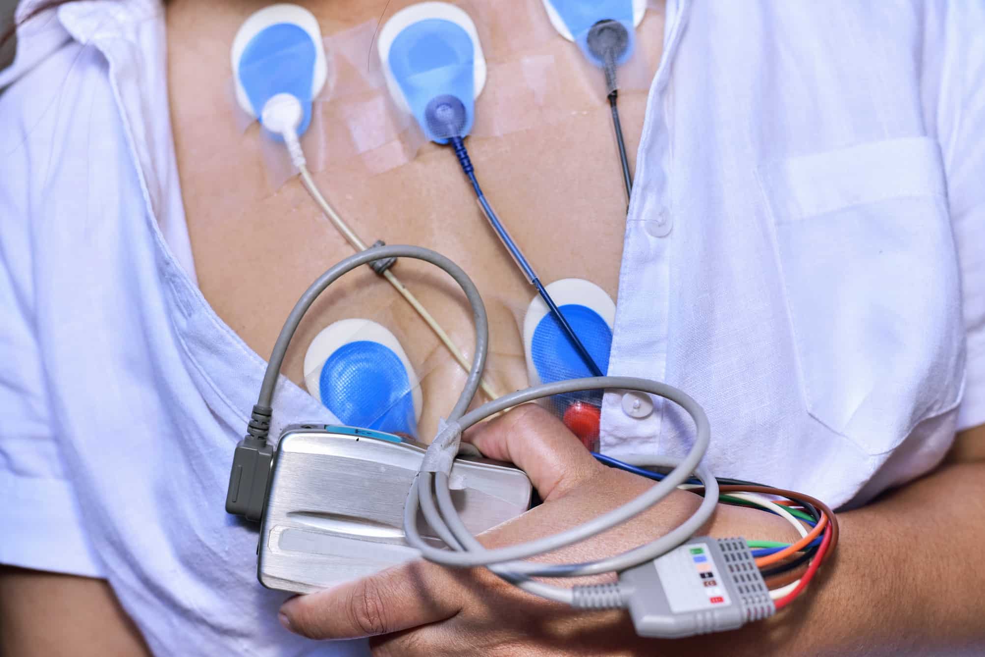 Holter de arritmias en Guayaquil para monitoreo continuo del ritmo cardíaco