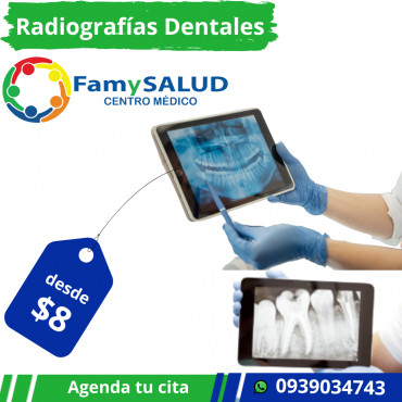 Las radiografías dentales no solo son una herramienta de diagnóstico, ¡son una parte esencial de tu cuidado dental ¿Por qué son importantes? Nos permiten detectar problemas que no se ven a simple vista, como: • Caries entre dientes • Infecciones en e