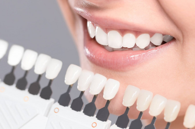 Diseño de Sonrisa