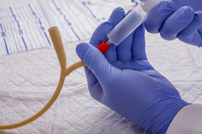 Colocación de Sonda